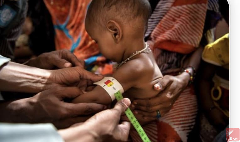 Une étude révèle les causes de la malnutrition en Mauritanie